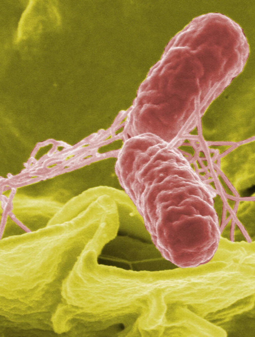 Salmonella enterica