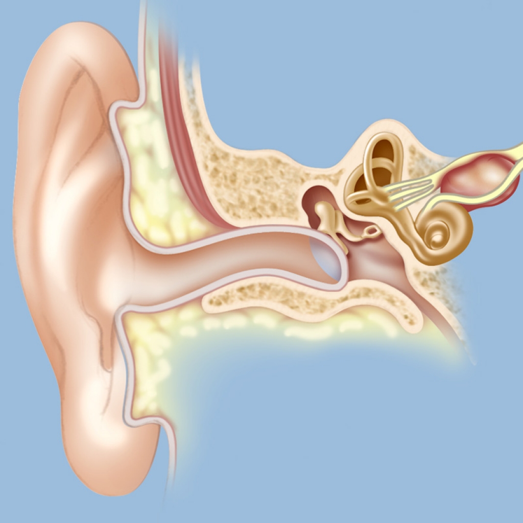 Заложило ухо горы. Невринома слухового нерва (акустическая шваннома). Невринома слухового нерва внутреннего уха. Акустическая невринома опухоль слухового нерва. Слуховой нерв строение невринома.